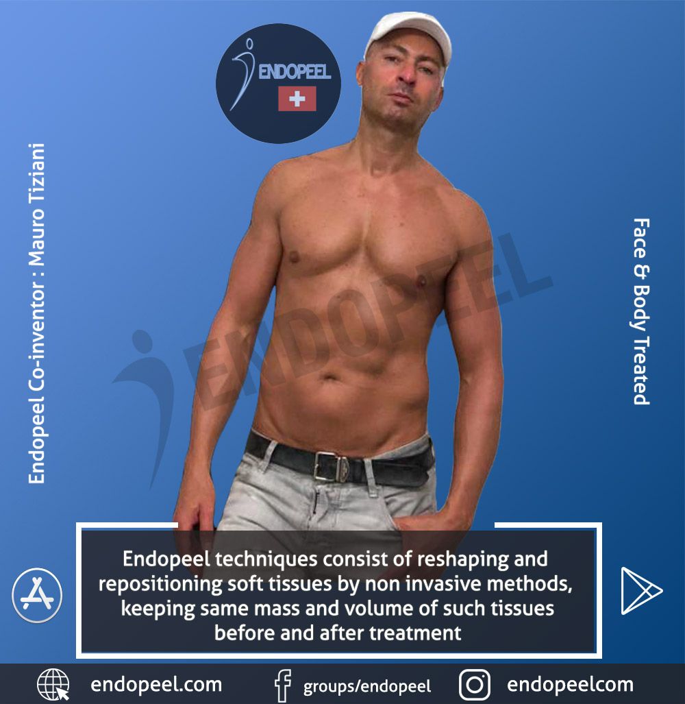 Endopeel Co Inventor Mauro Tiziani