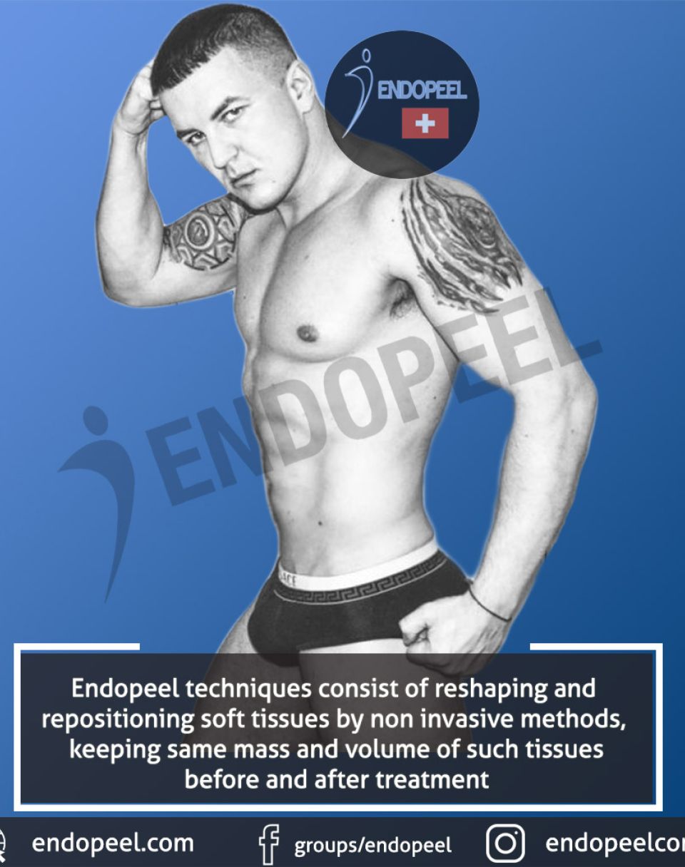 endopeel-social-media-flyer